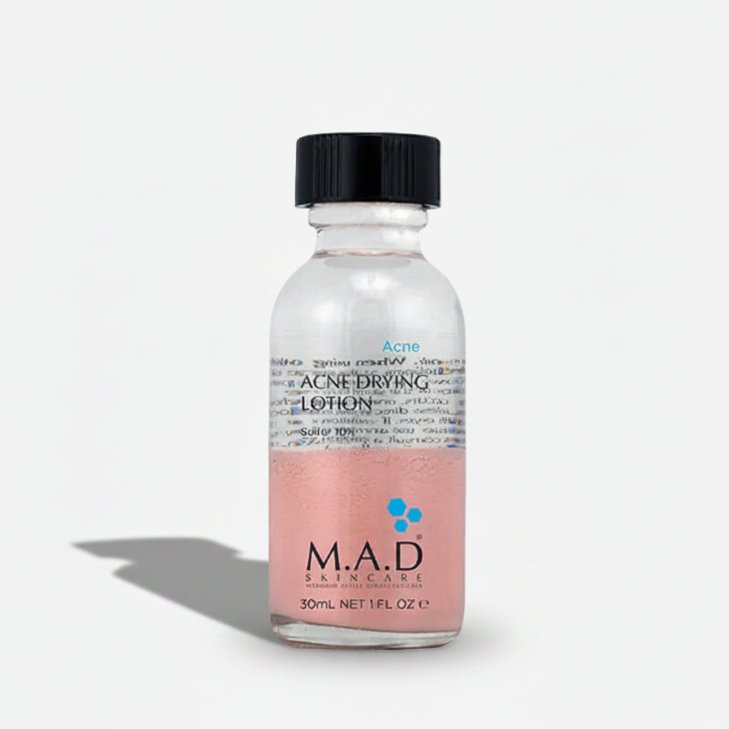 M.A.D Skincare - Lokalaus Naudojimo Spuogus Džiovinantis Losjonas (10% Sieros), 30 ml